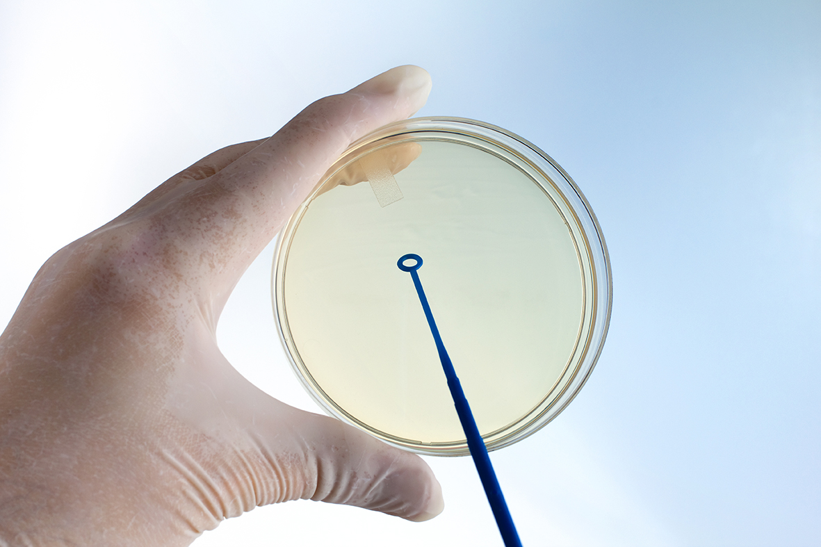 Did you know that agar is used in diagnostic tests?