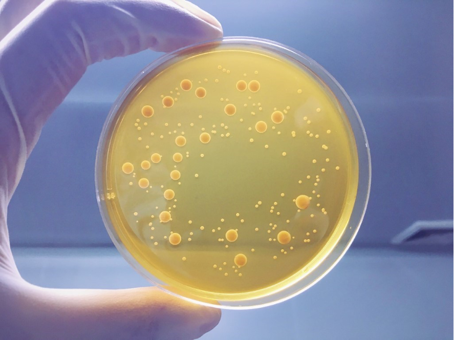 | qué se utiliza agar en microbiología?