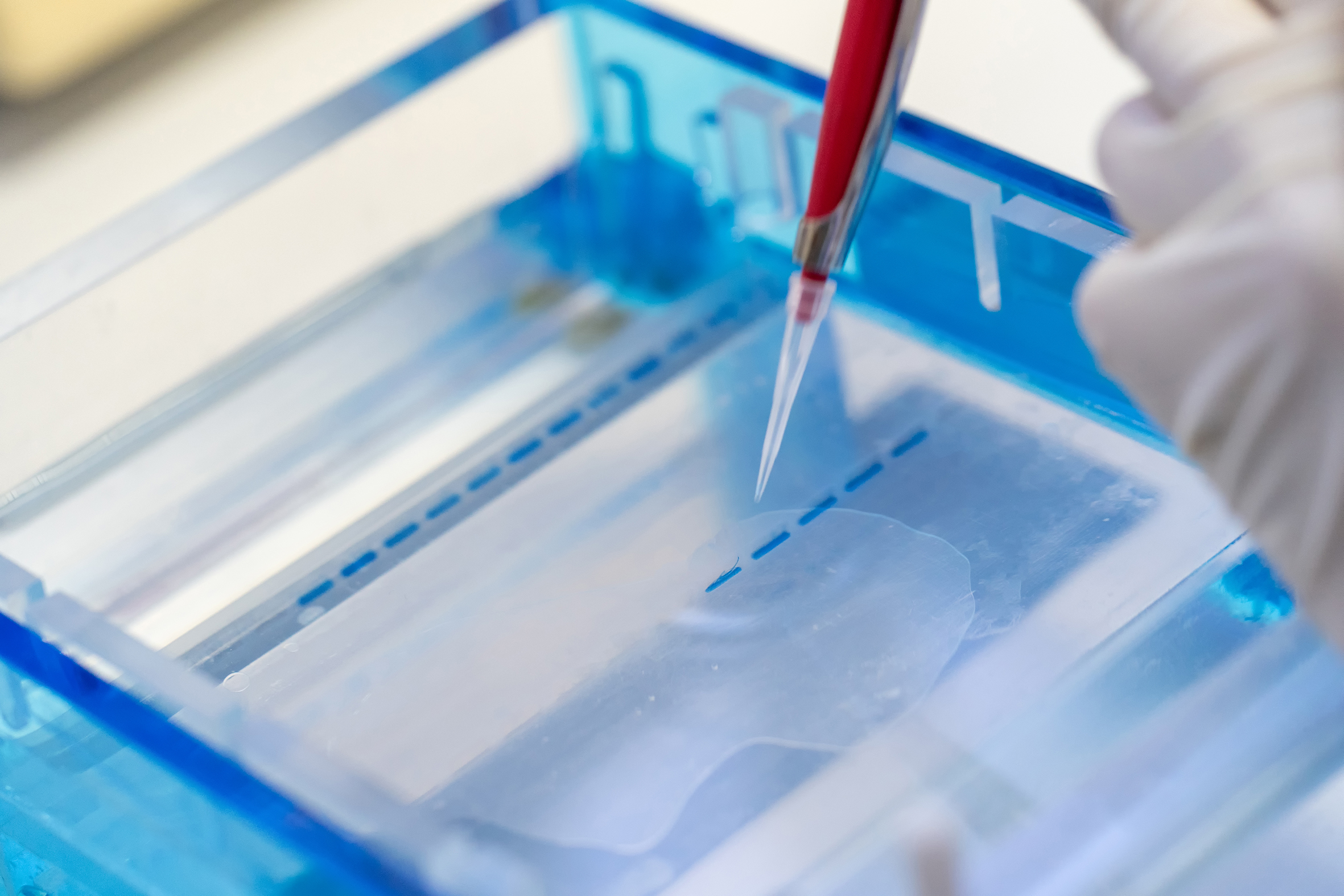 electrophoresis electrophoresis